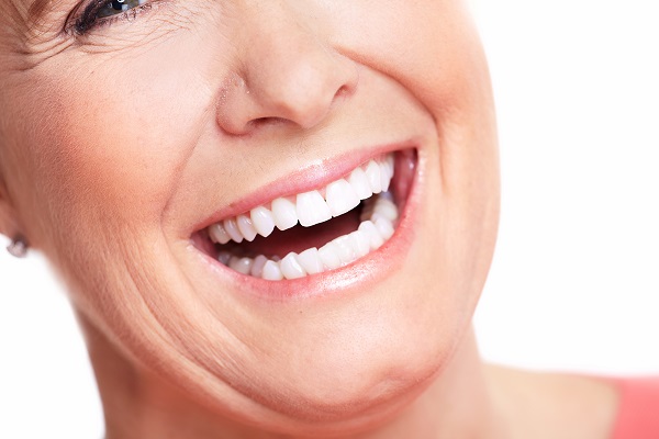 Full Mouth Reconstruction: FAQs